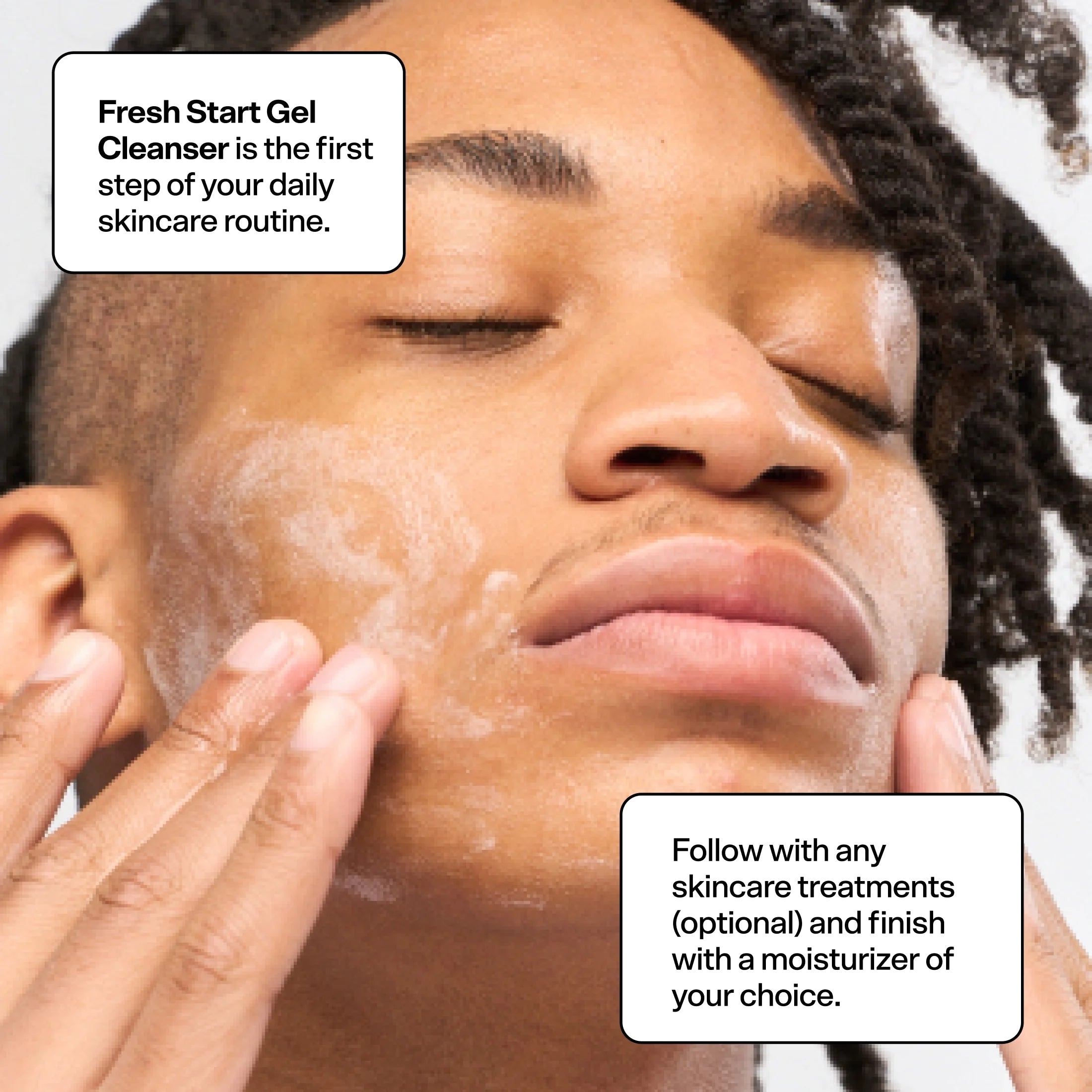 Acne Skincare Kit for All Skin Types, 3 Items a7