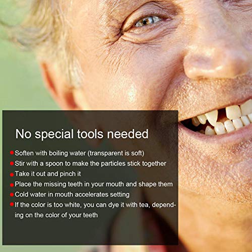 Teeth Repair Beads for Missing Tooth Filling Material 10g a7